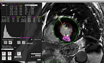 CMRSegTools