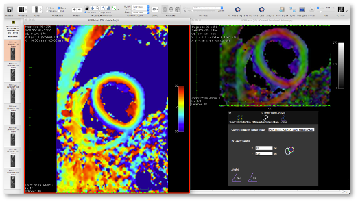 CMRDiffTools