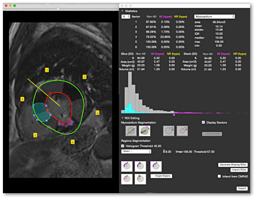 CMRSegTools