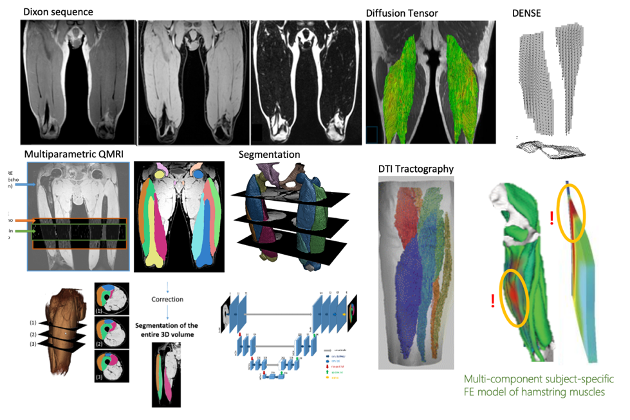 Multiparametric imaging protocol for advanced muscle investigation. Illustration.