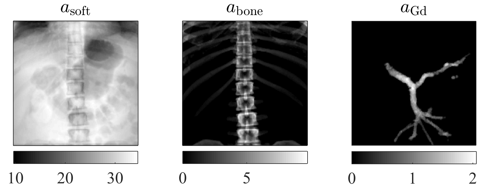 Material decompostion in a thorax phantom