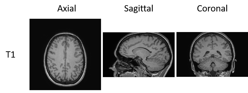 Machine learning medical image classification notebooks