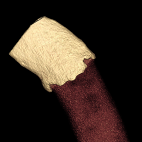 rib