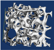 trabecular bone