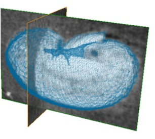 kidney