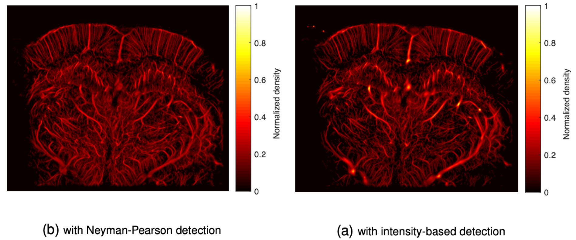 Ultrasound Localization Microscopy