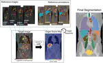 Local SURF-based Keypoint Transfer Segmentation