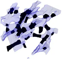 Graph-based multi-scale analysis of plates and rods in human trabecular bone