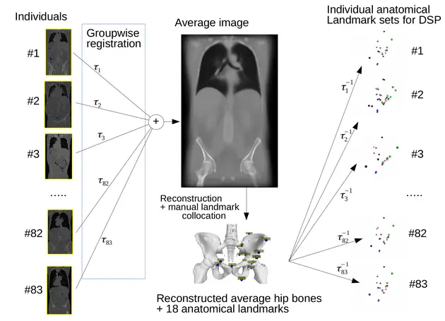 The prospects for application of computational anatomy in forensic anthropology for sex determination