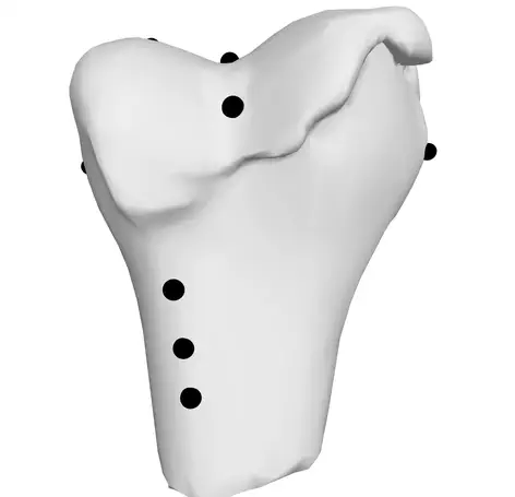 Multi-atlas automatic positioning of anatomical landmarks