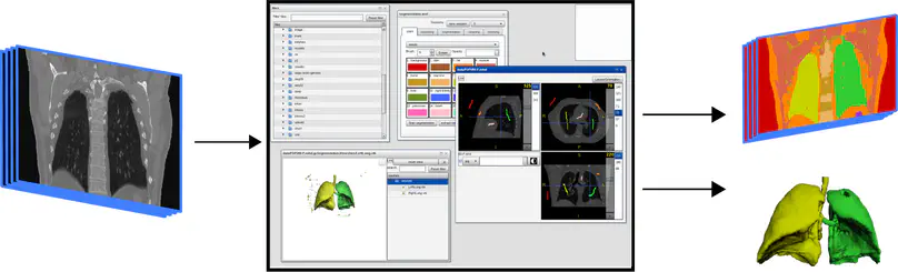 A web interface for 3D visualization and interactive segmentation of medical images