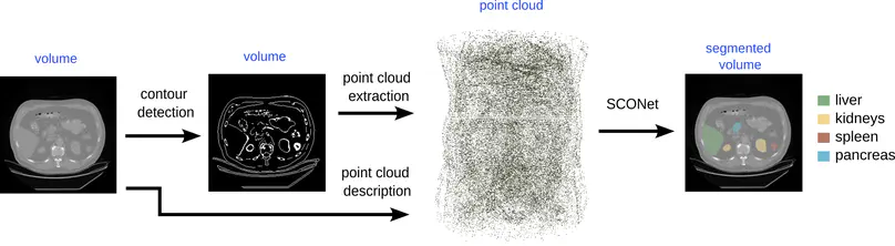 SCONet: Convolutional Occupancy Networks For Multi-Organ Segmentation