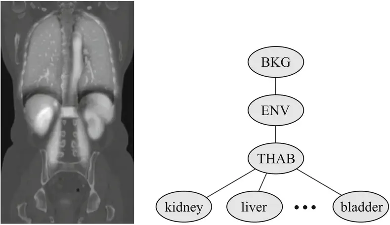 Automatic Multiorgan Segmentation Using Hierarchically Registered Probabilistic Atlases