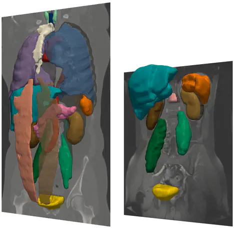 Automatic Multiorgan Segmentation via Multiscale Registration and Graph Cut