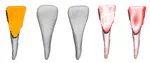 High-Fidelity 3D Tooth Reconstruction by Fusing Intraoral Scans and CBCT Data via a Deep Implicit Representation