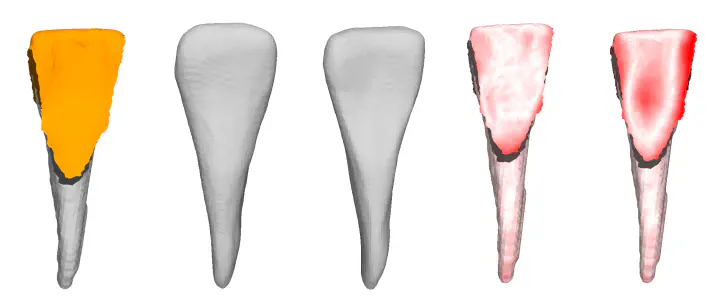 High-Fidelity 3D Tooth Reconstruction by Fusing Intraoral Scans and CBCT Data via a Deep Implicit Representation